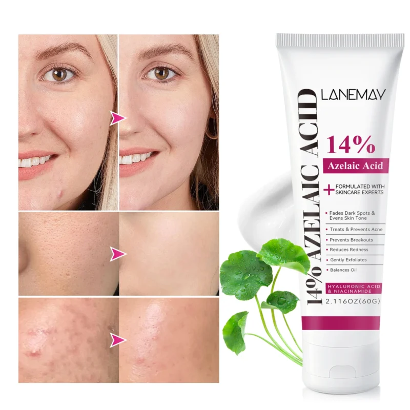 14 Azelaic Acid Face Cream Acne Treatment Spu1017407977448 3