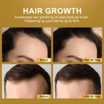 Biotin Scalp Care Essence Spray Spu1010840394771 3