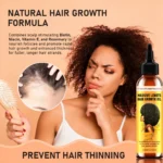 Hair Growth Oil Scalp Treatment - MASSIVE LENOTS Biotin & Rosemary Nourishing Essence for Thicker Hair (120ml)