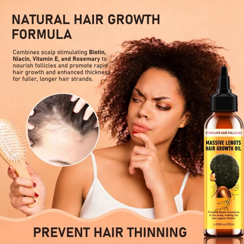 hair-growth-oil-massive-lenots-biotin-rosemary-spu1014953311593-1 Hair Growth Oil Scalp Treatment - MASSIVE LENOTS Biotin & Rosemary Nourishing Essence for Thicker Hair (120ml)