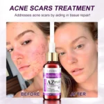 Lanemay Azelaic Acid 10 Serum Spu1017998290159 3