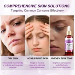 Lanemay Azelaic Acid 10 Serum Spu1017998290159 4