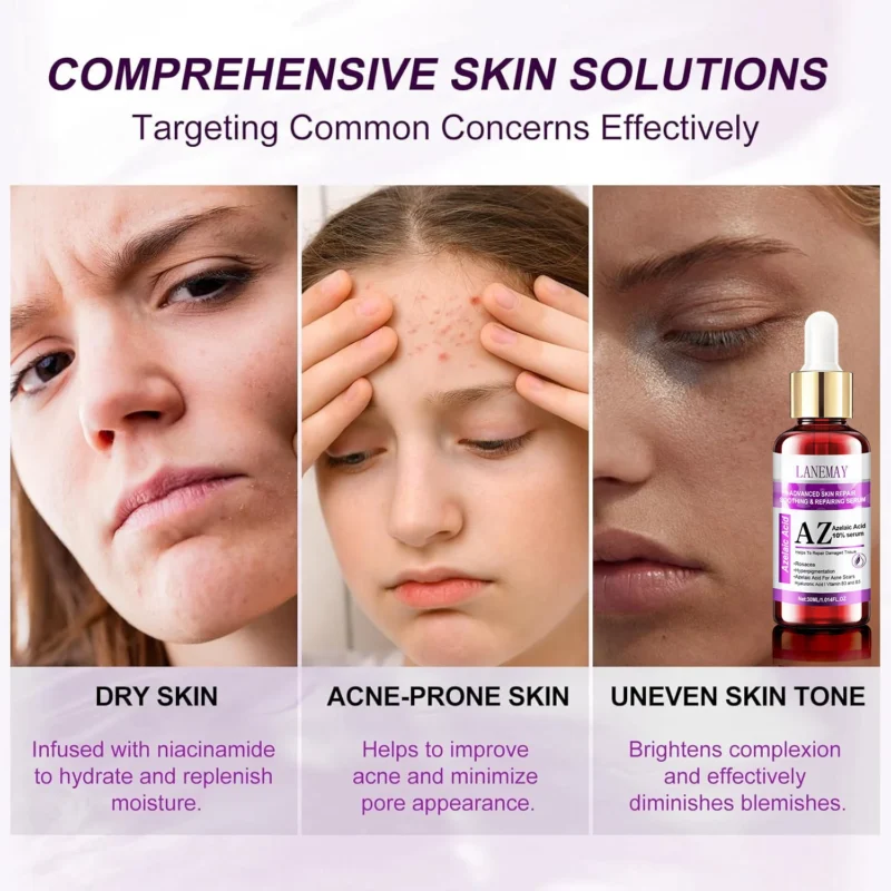 Lanemay Azelaic Acid 10 Serum Spu1017998290159 4