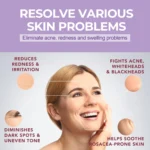 Lanemay Azelaic Acid Niacinamide Serum Redness Relief Spu1003828083286 4