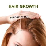 Lanemay Ginger Hair Growth Serum 30ml Spu1017352295711 3