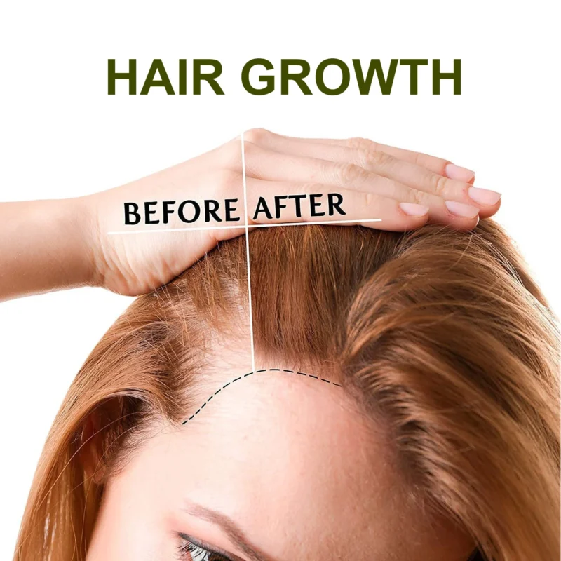 Lanemay Ginger Hair Growth Serum 30ml Spu1017352295711 3