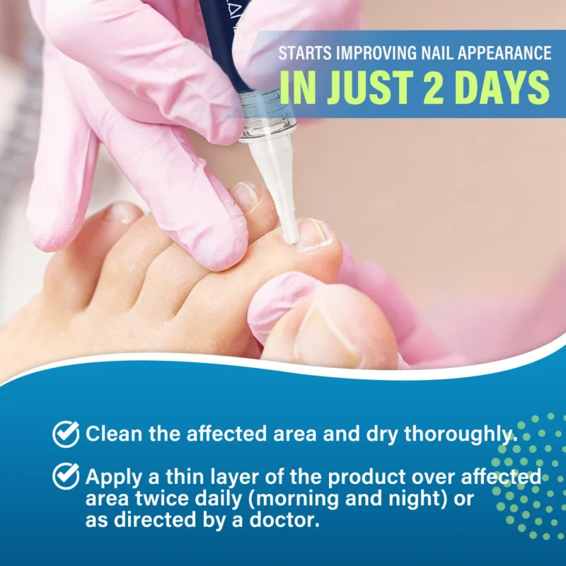 Lanemay Nail Repair Pen Antifungal Treatment Spu1016486362844 2