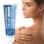 LANEMAY Scar Removal Cream & Stretch Mark Fader - Skin Repair Balm for Acne Scars, Burns & Surgery Marks with Shea Butter & Centella (60g)