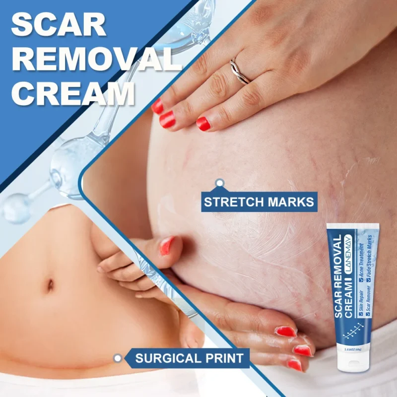 Lanemay Scar Removal Cream Stretch Mark Repair Spu1018138336798 3