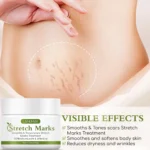 Lanemay Stretch Mark Cream Repair Spu988735432928 2