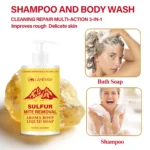 Sulfur Body Wash Mite Removal Lanemay Spu1006179847094 3