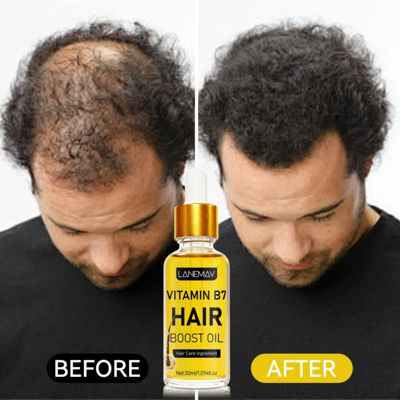 Vitamin B7 Hair Boost Oil for Growth and Strength - Nourishing Scalp & Hair Essence 30ml